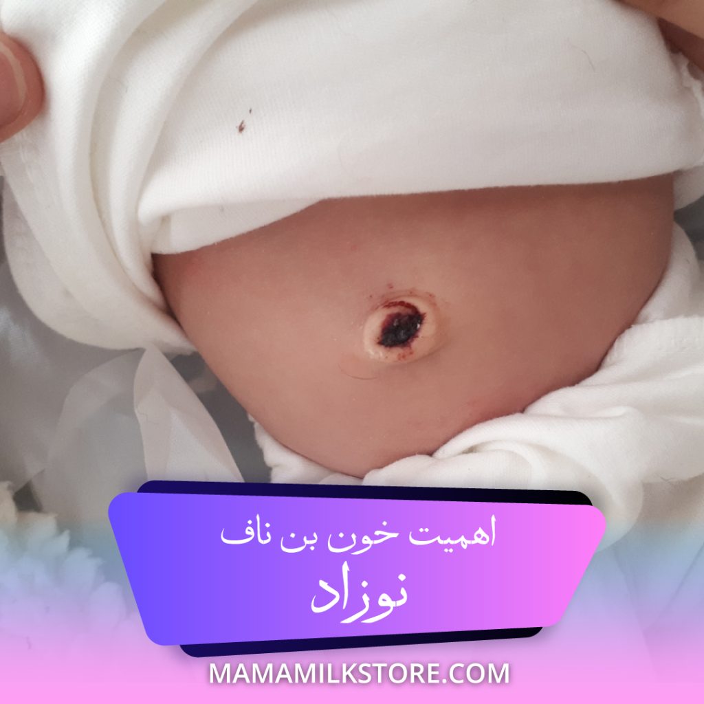 اهمیت خون بند ناف نوزاد
