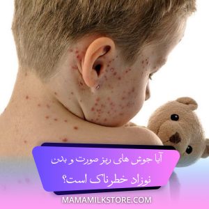 جوش های ریز صورت و بدن نوزاد